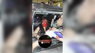 Two Women Injured In Car Accident In Bogota