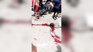 Two Motorcycles Collided, Killing A Young Nurse